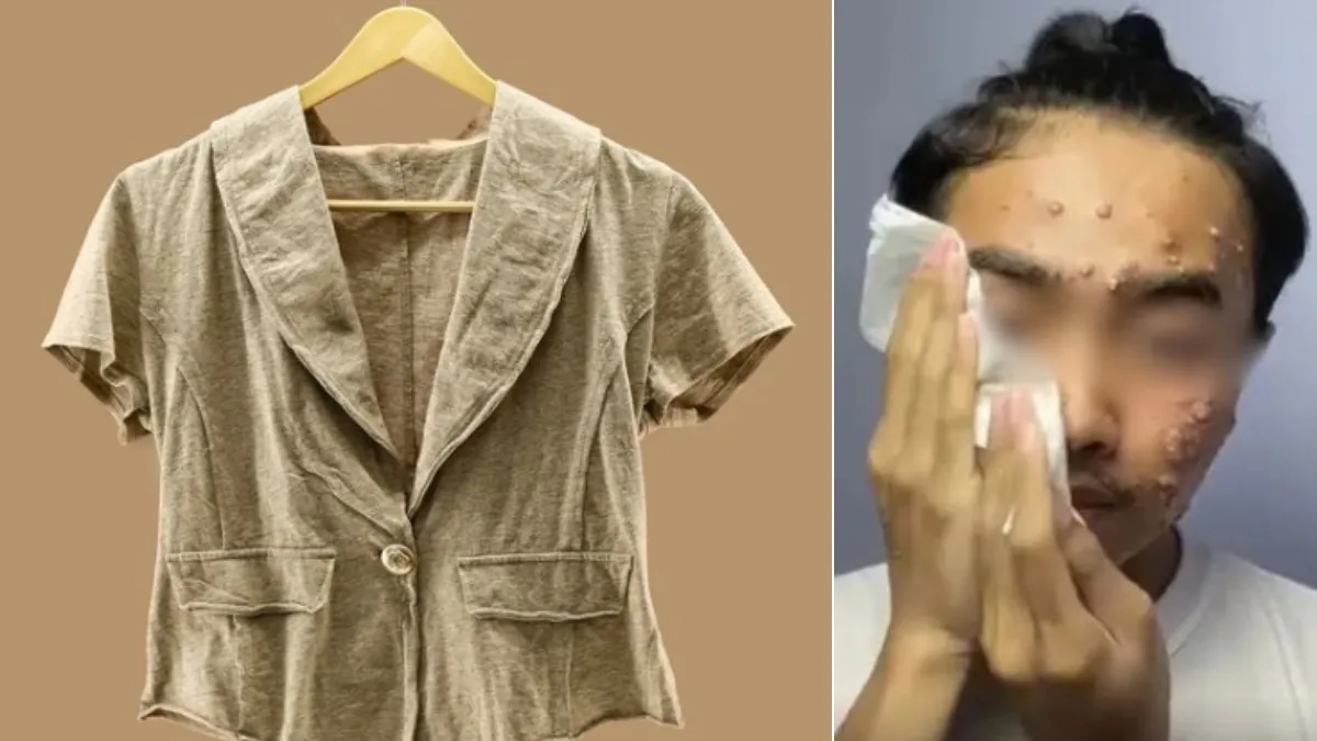 सेकंड हैंड कपड़े पहनना हो सकता है खतरनाक, इस शख्स के साथ हुआ कुछ ऐसा