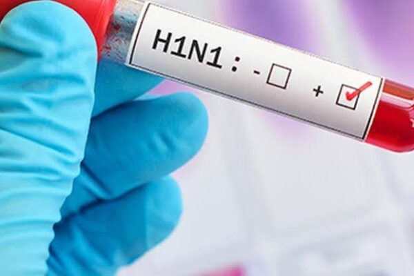 H1N1 नया स्ट्रेन नहीं, ICMR ने कहा- घबराने की जरूरत नहीं